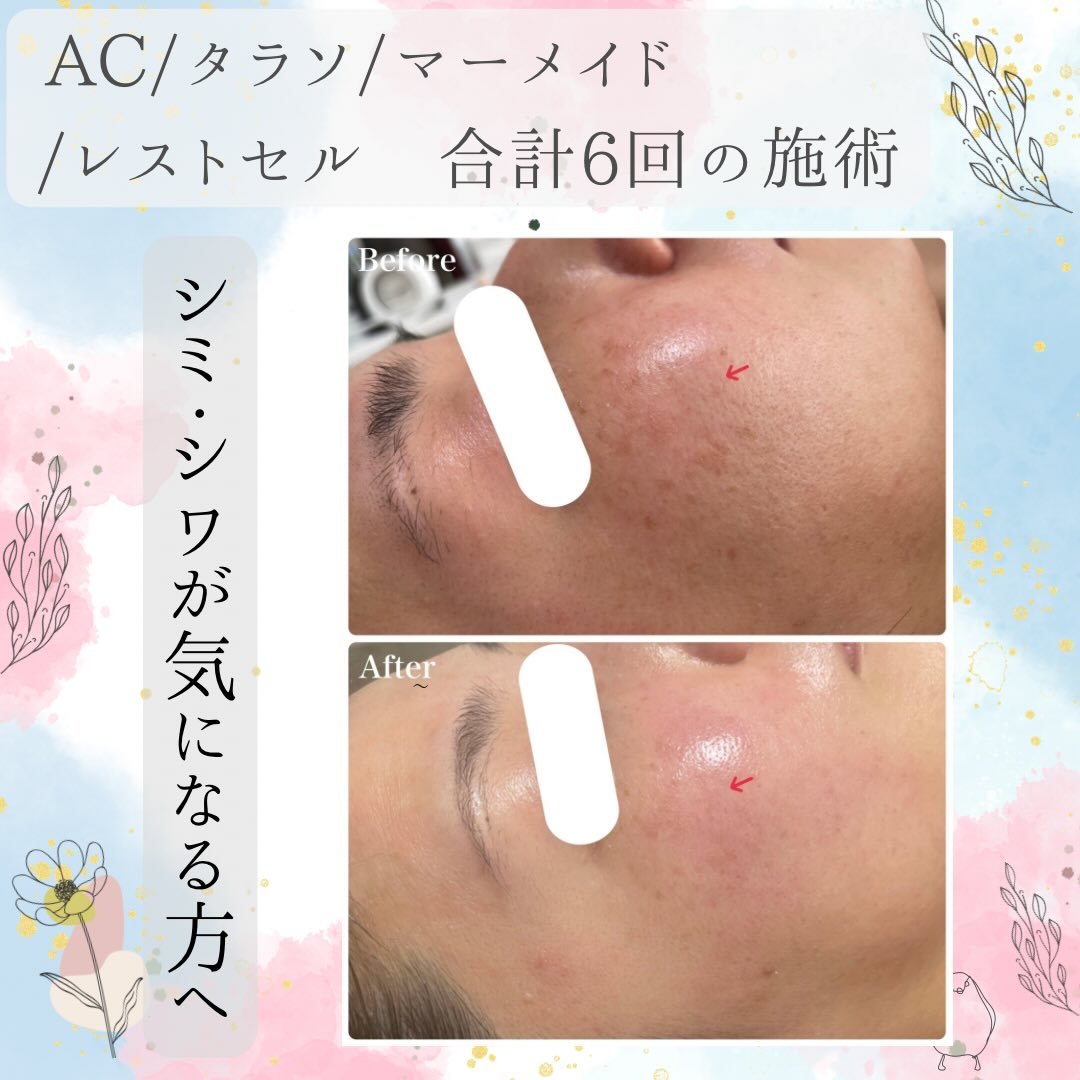 ギャラリー | RE L'ABEAUTE（リアボーテ）