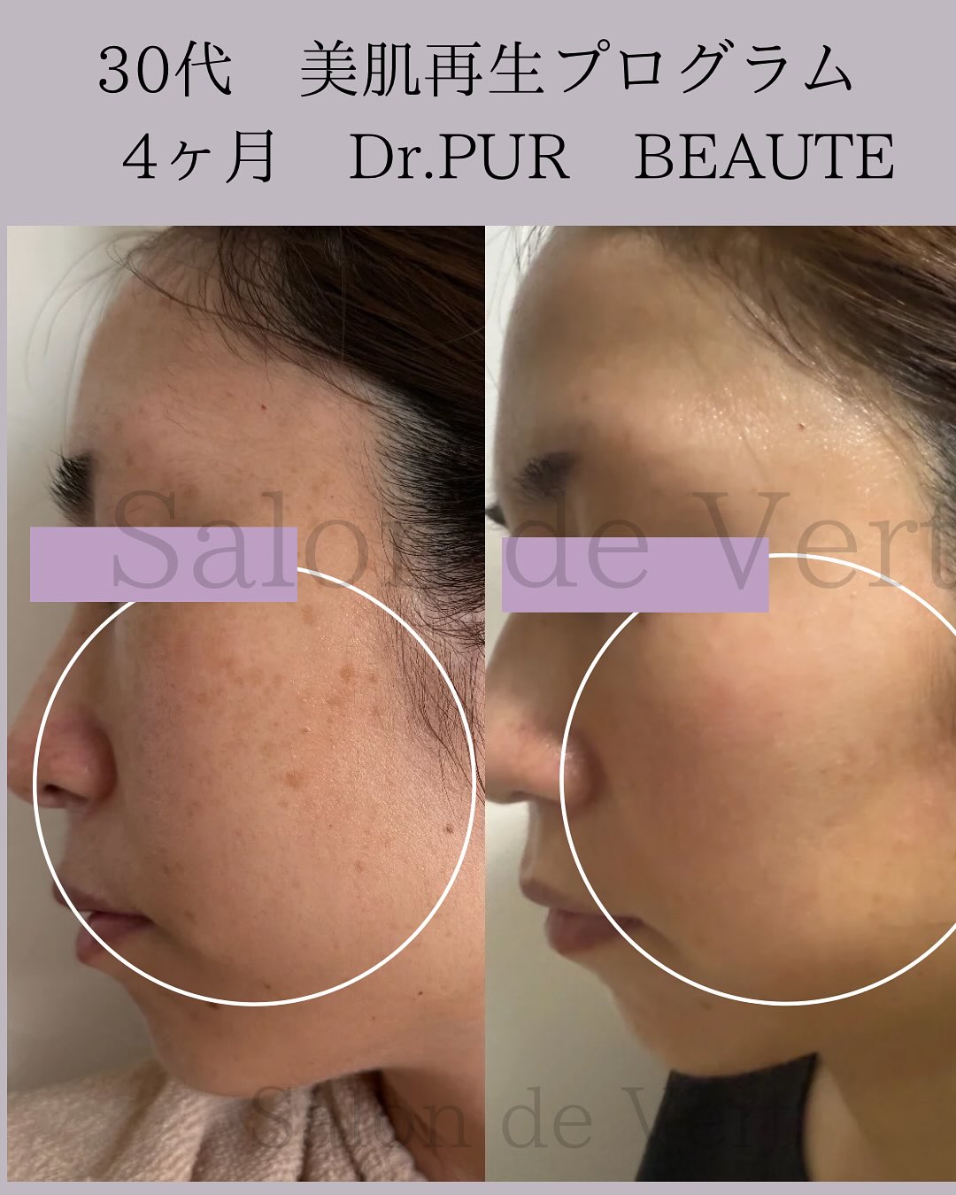 ブランドに関するお声 on Instagram | ドクターピュールボーテ