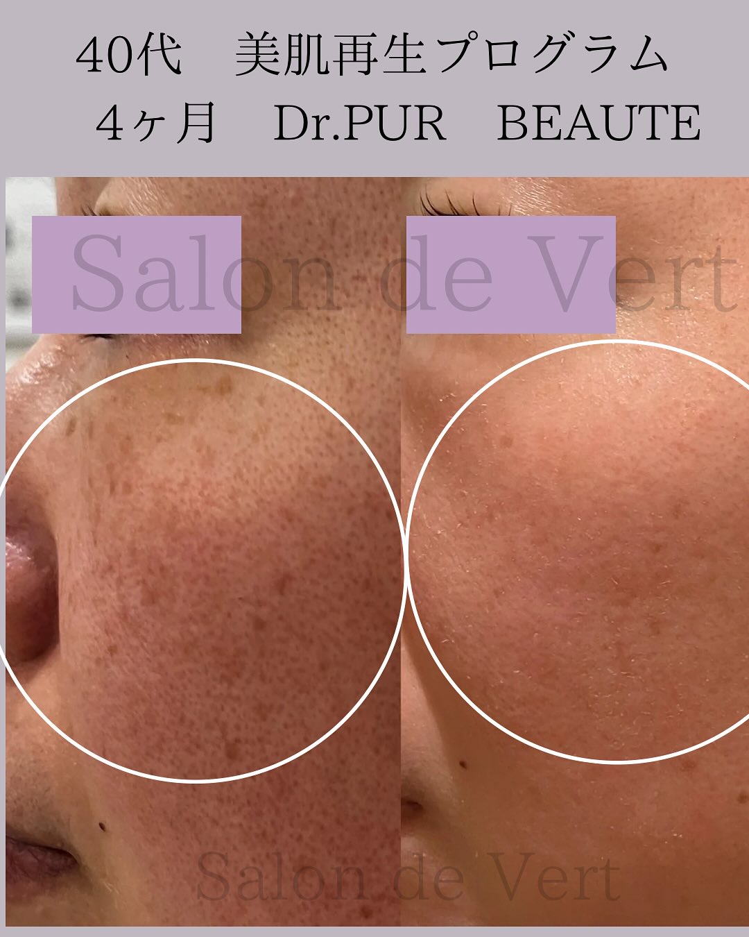 ブランドに関するお声 on Instagram | ドクターピュールボーテ