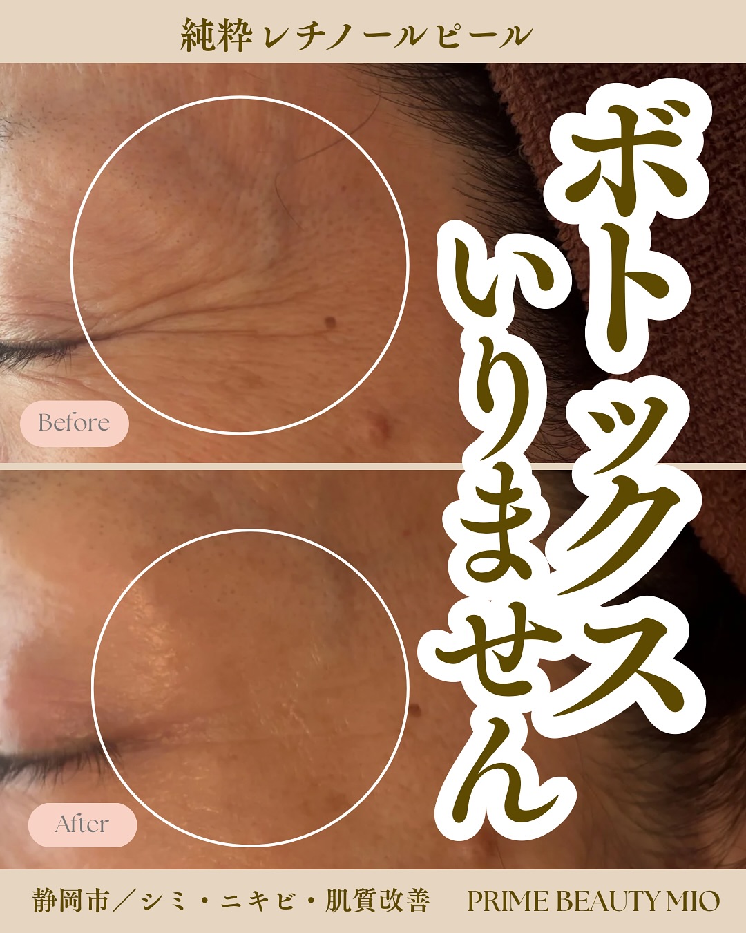 ブランドに関するお声 on Instagram | ドクターピュールボーテ