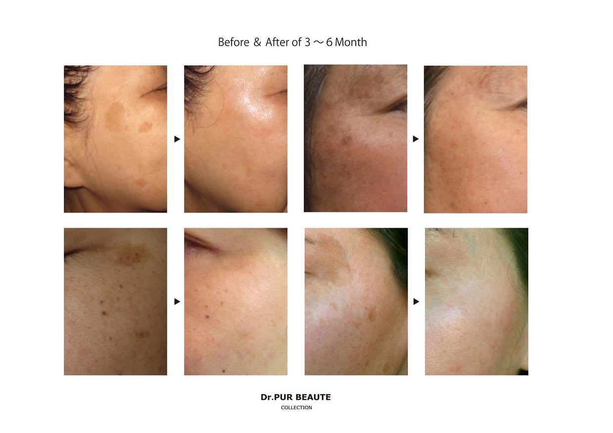 ブランドに関するお声 on Instagram | ドクターピュールボーテ