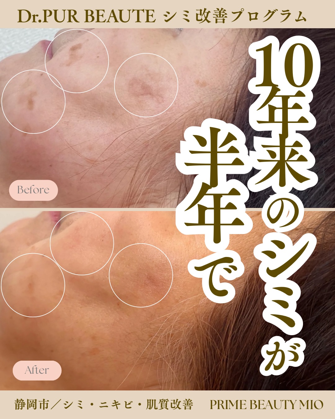 ブランドに関するお声 on Instagram | ドクターピュールボーテ