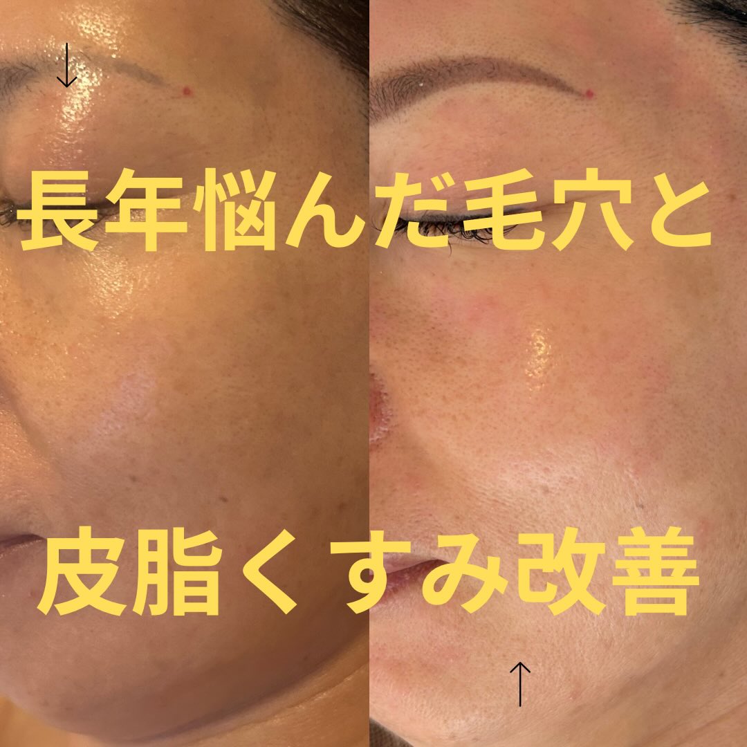 ブランドに関するお声 on Instagram | ドクターピュールボーテ