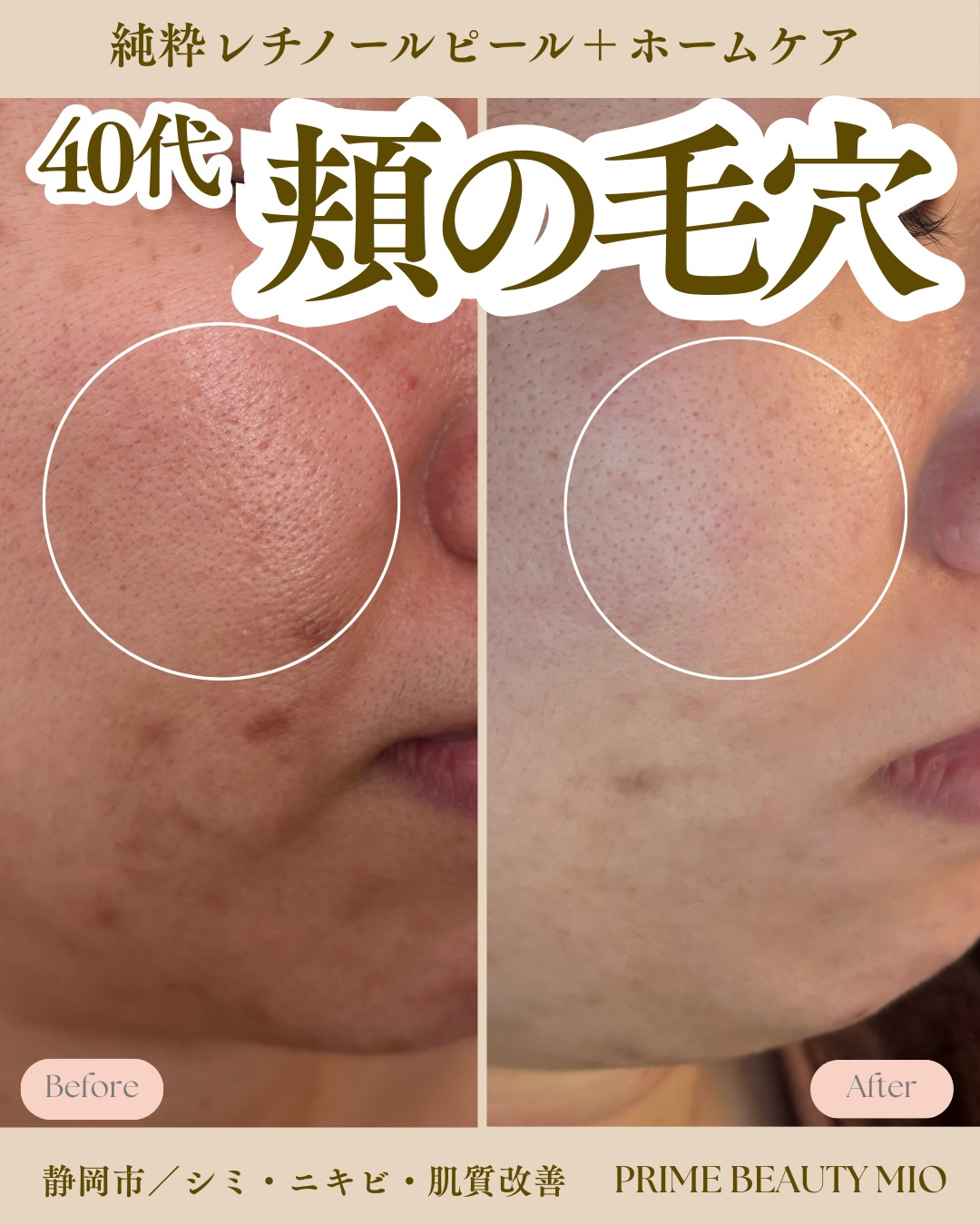 ブランドに関するお声 on Instagram | ドクターピュールボーテ